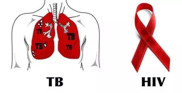 结核病虽然是致命的杀手,但只要做到早期诊治,可以大幅度降低病死率
