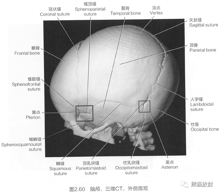 断解选读丨脑颅之“缝”、“囟”~_闭合_颅骨_解剖