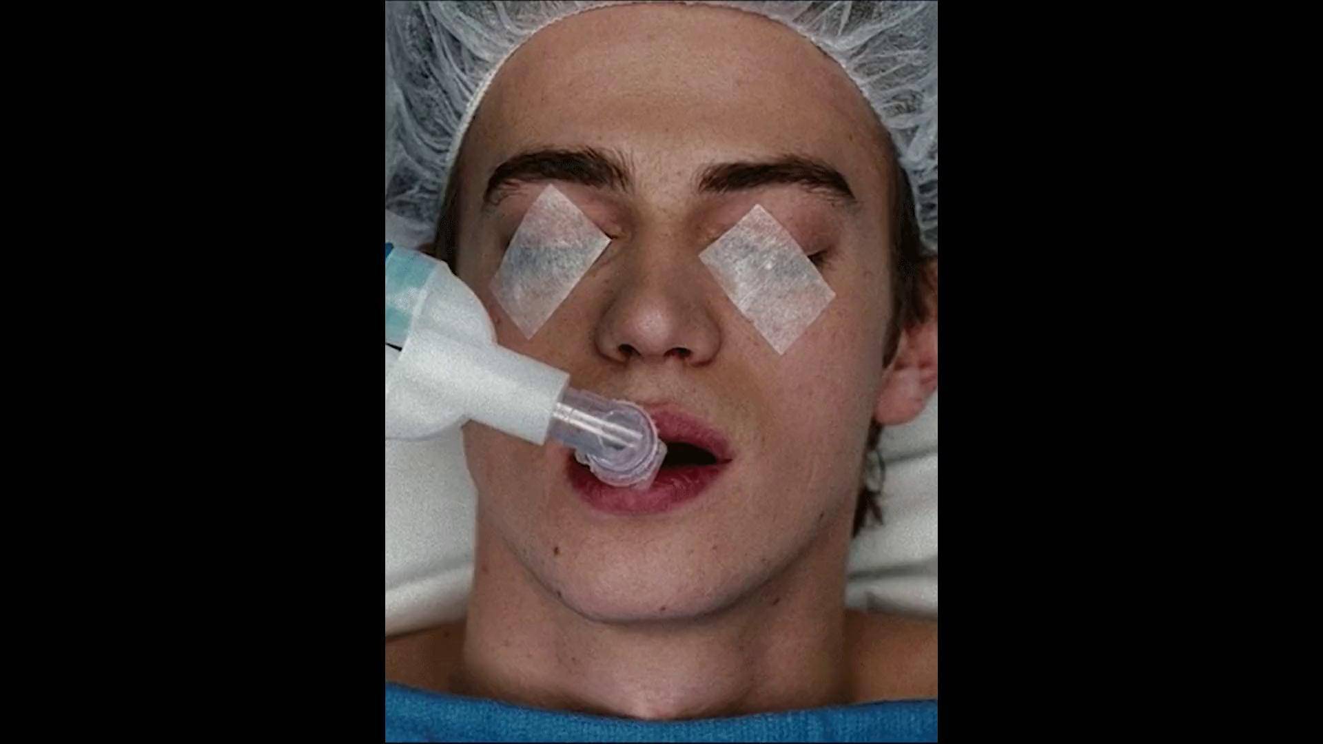 最cd的手术,被活生生开膛破肚 我的观影报告