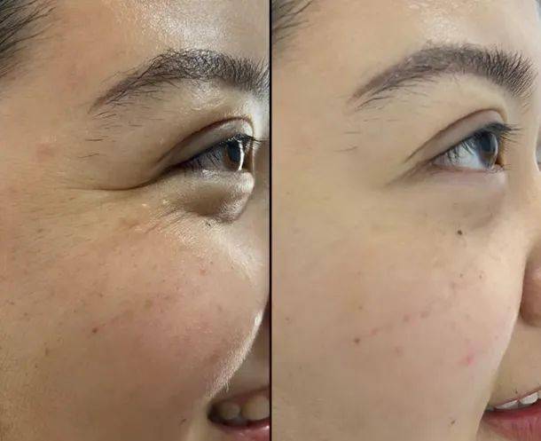 63岁宛若18岁少女,美成这样,竟然只靠睡前这件小事…_保养_人类_日本