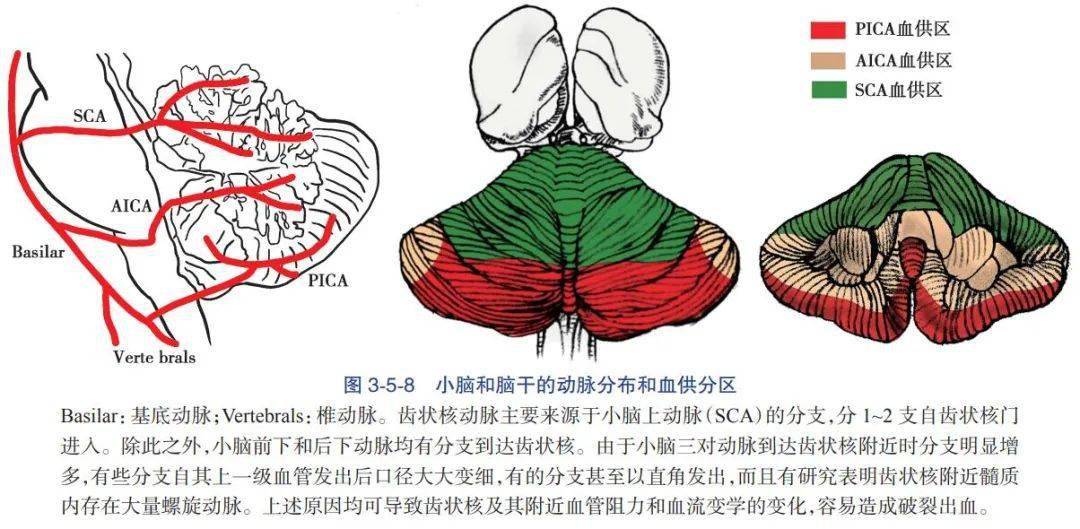 乙状窦沟图片