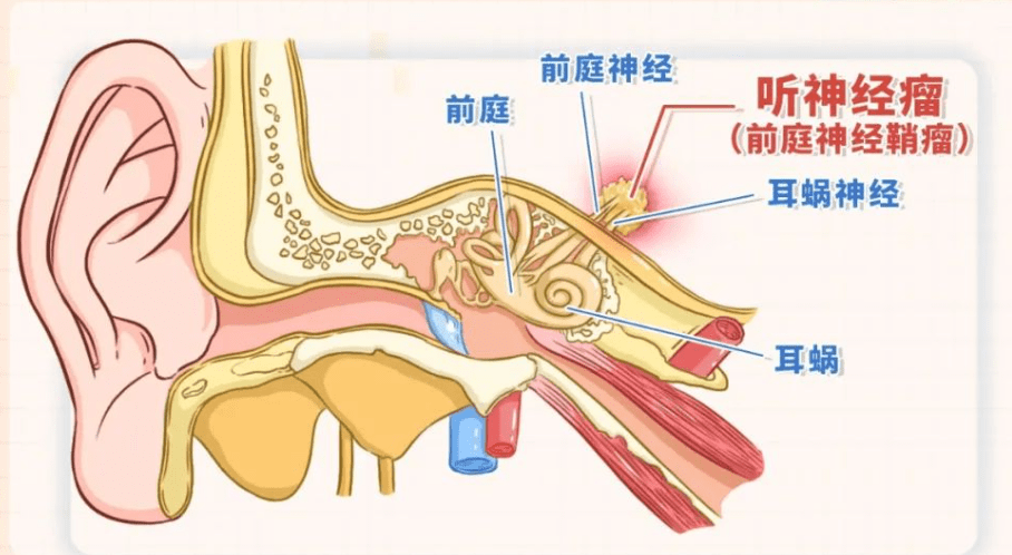 面听神经解剖图片