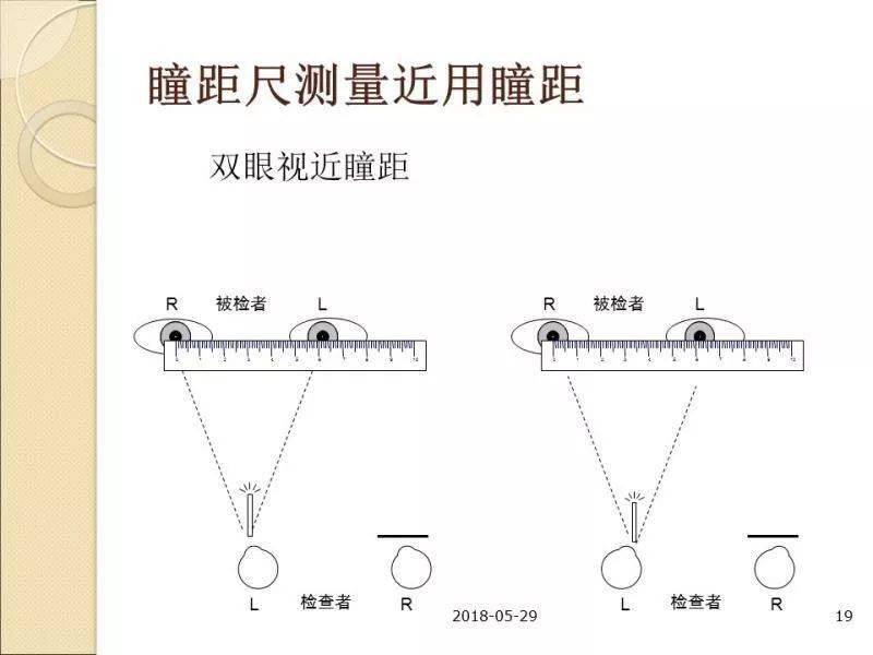 瞳距宽窄图片