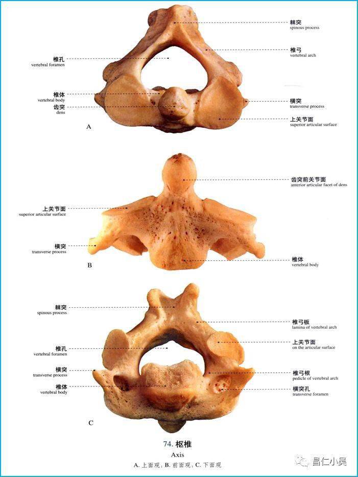 颈3椎体解剖图片