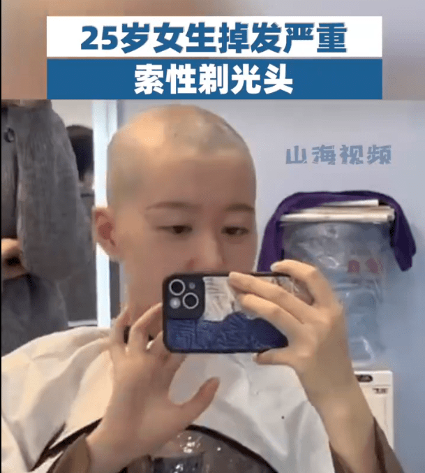 女生掉发严重索性剃光头,能摆脱发量焦虑?_头发_网友_头皮