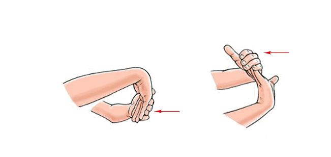 再扳住患侧手掌或手指使腕关节尽量背伸,维持姿势不动;4