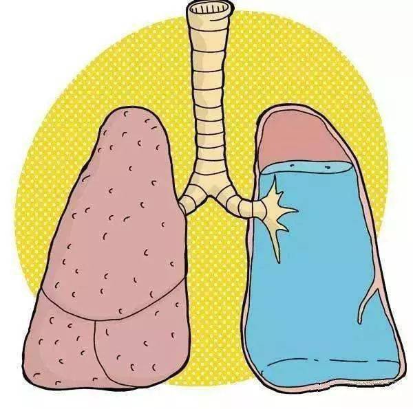 但是水经过呼吸道吸入了肺部,导致肺水肿,进而因为无法呼吸而死亡