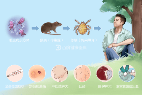 恙虫病立克次体图片图片