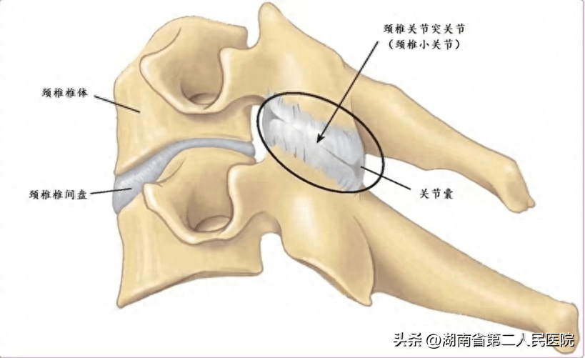 关节紊乱之颈椎小关节紊乱_肌肉_进行_治疗