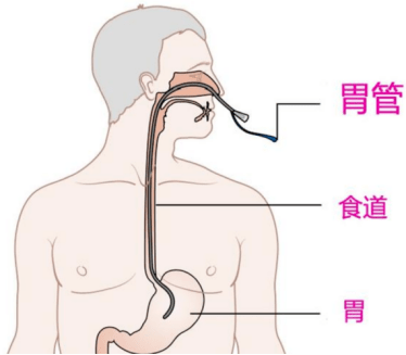 气管与胃管的结构图图片