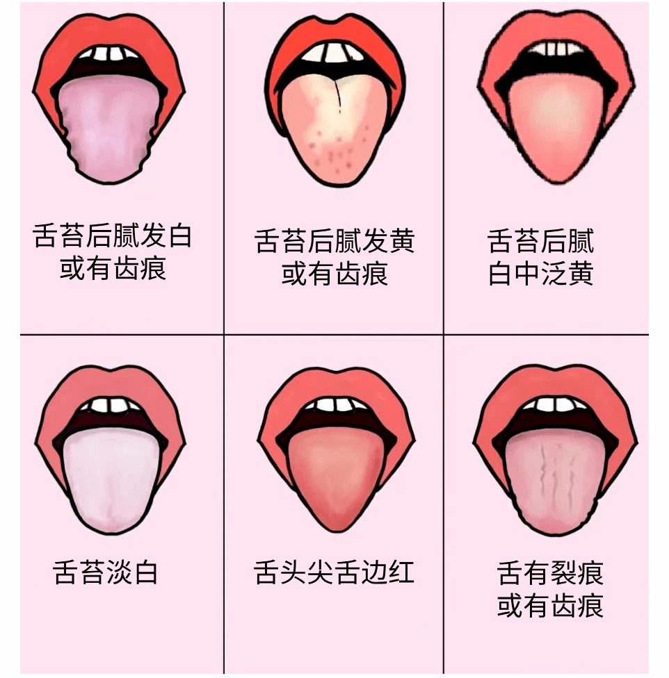 舌苔