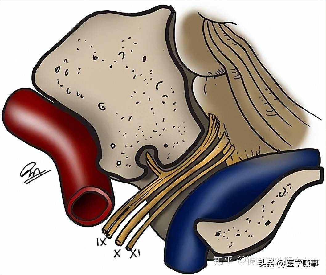 颈静脉孔区解剖彩图图片