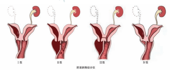 宫颈贴膜照片图片