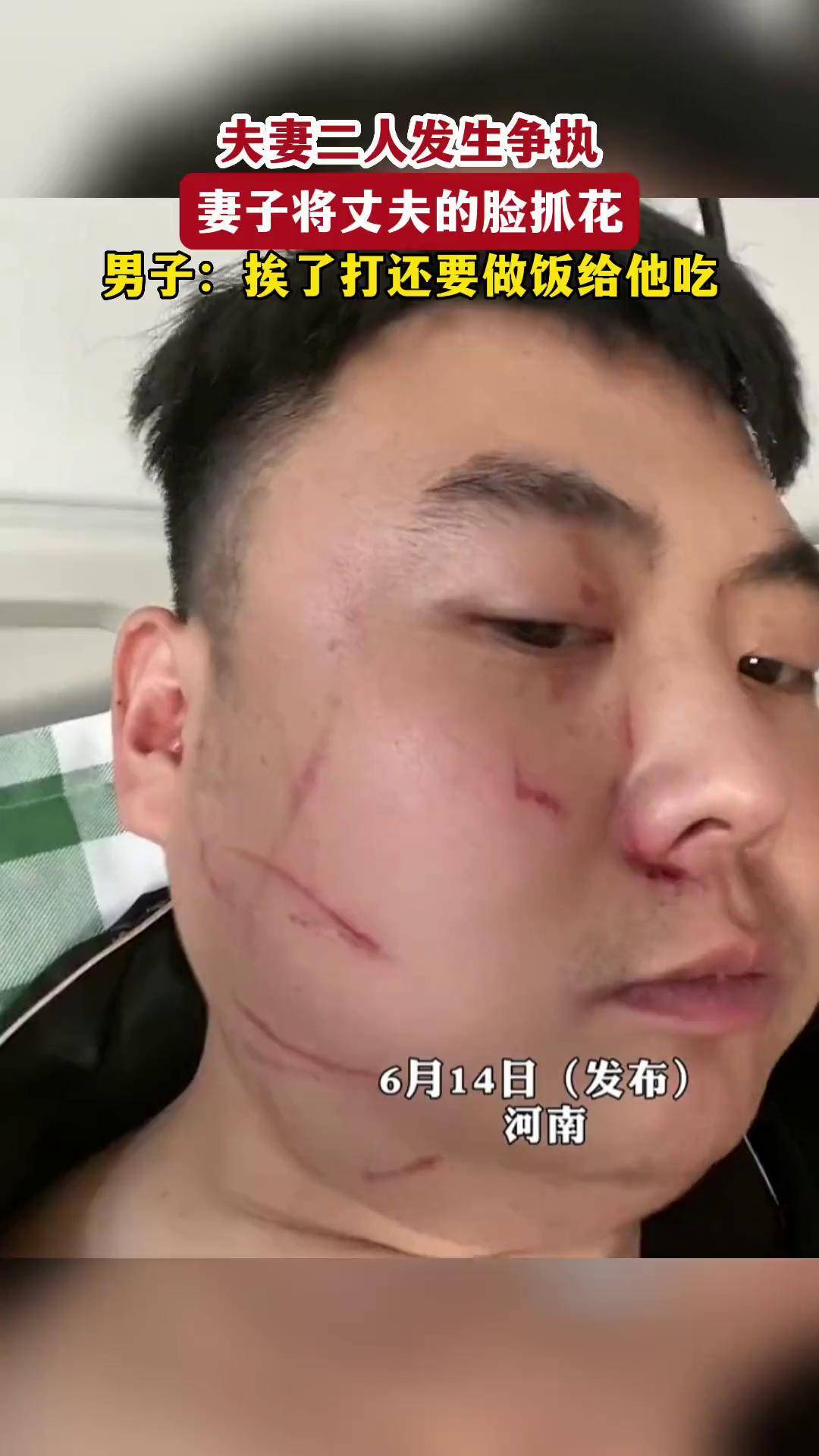 夫妻二人发生争执丈夫的脸被妻子抓花有一种爱是你在08