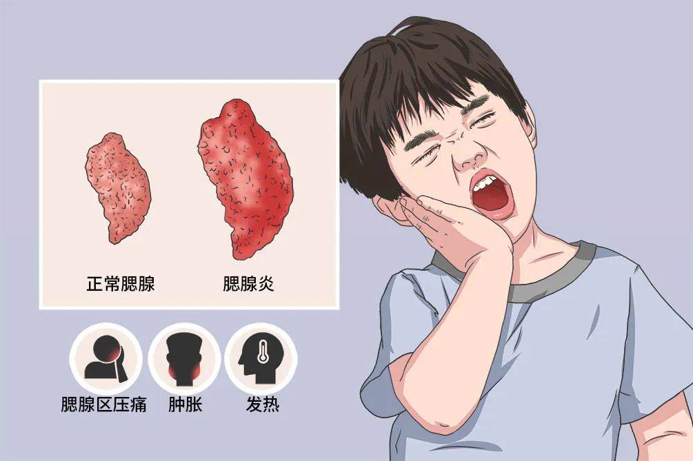 什么是流行性腮腺炎一陕西疾控最新提醒!传染性很强