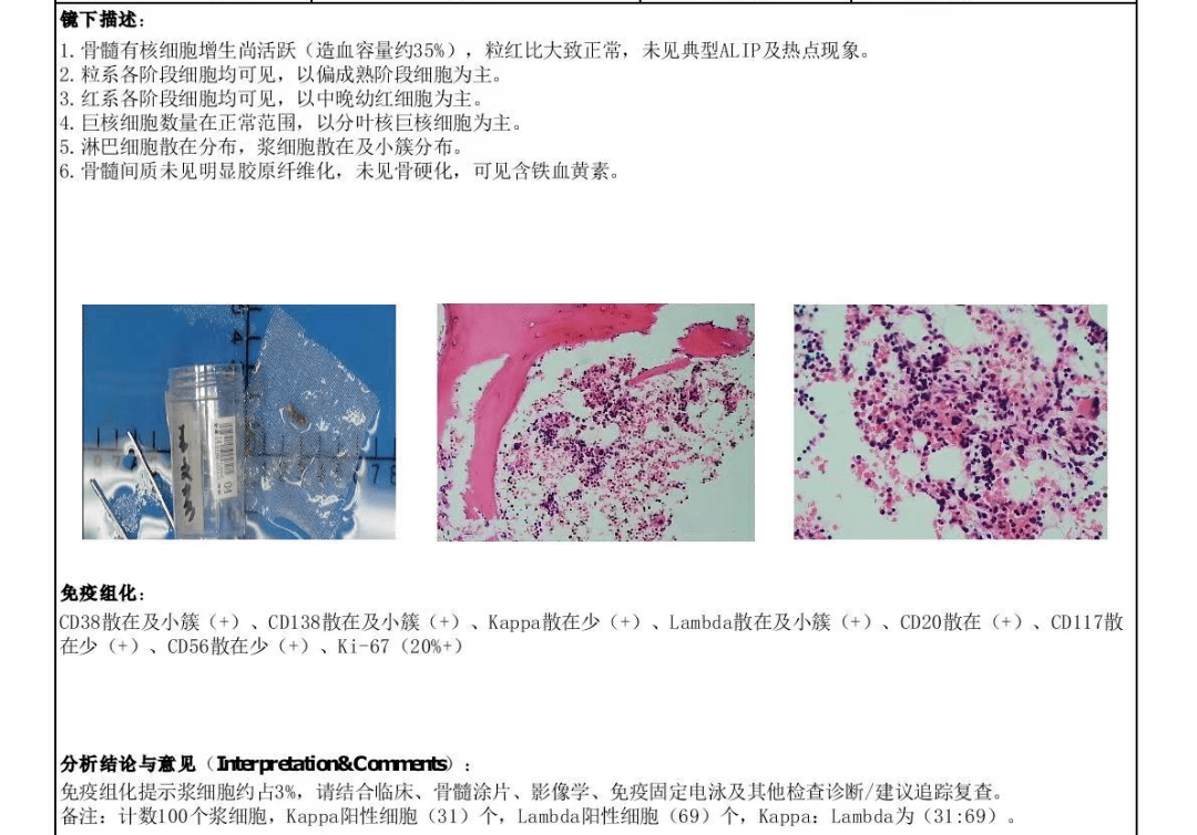 肝脏米老鼠征b超图图片