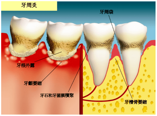 牙齿与牙床结构图图片