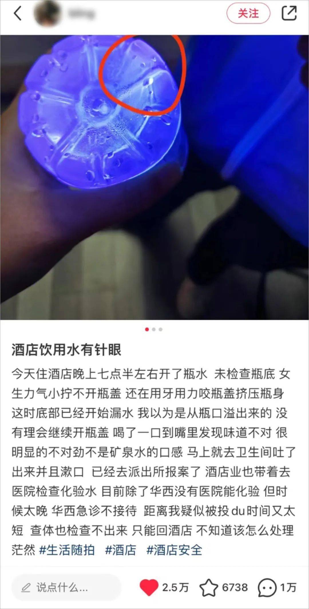 住个酒店好累,不仅得提防房间内是否有针孔摄像头,花洒软管,洗护用品
