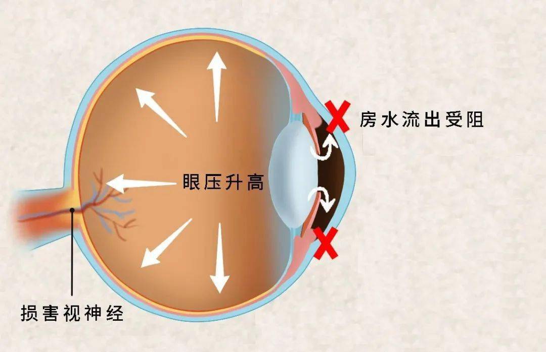 今日霜降,四大养生护眼妙招学起来