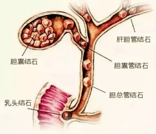 胆管