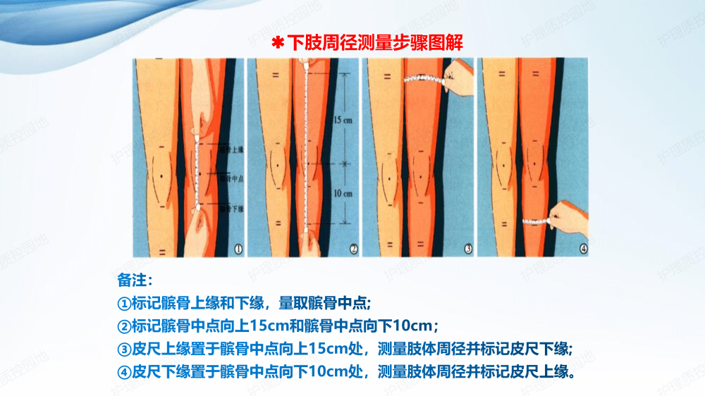 【ppt】下肢深静脉血栓行下肢周径规范测量专家共识_护理_直播_微信