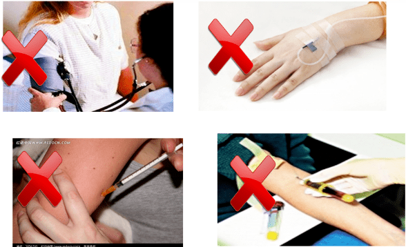 血液透析动静脉内瘘使用后,怎样避免内瘘血栓形成?_进行_评估_功能