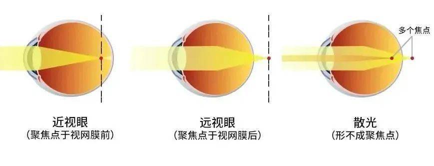 储备_临床_眼球