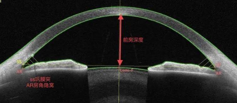 oct在眼前节的应用_测量_角膜_成像