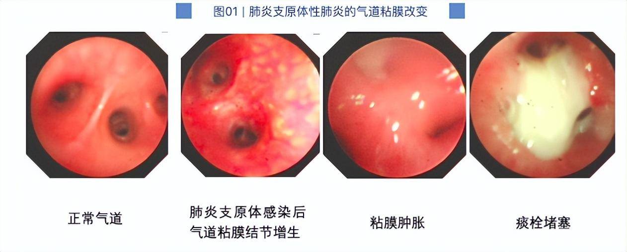 北戴河洗肺医院图片