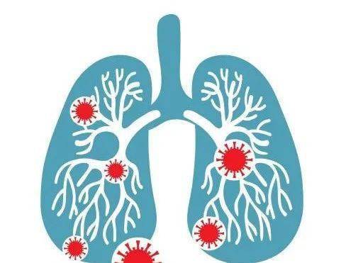 临城县人民医院成功救治一例重症支原体肺炎患儿