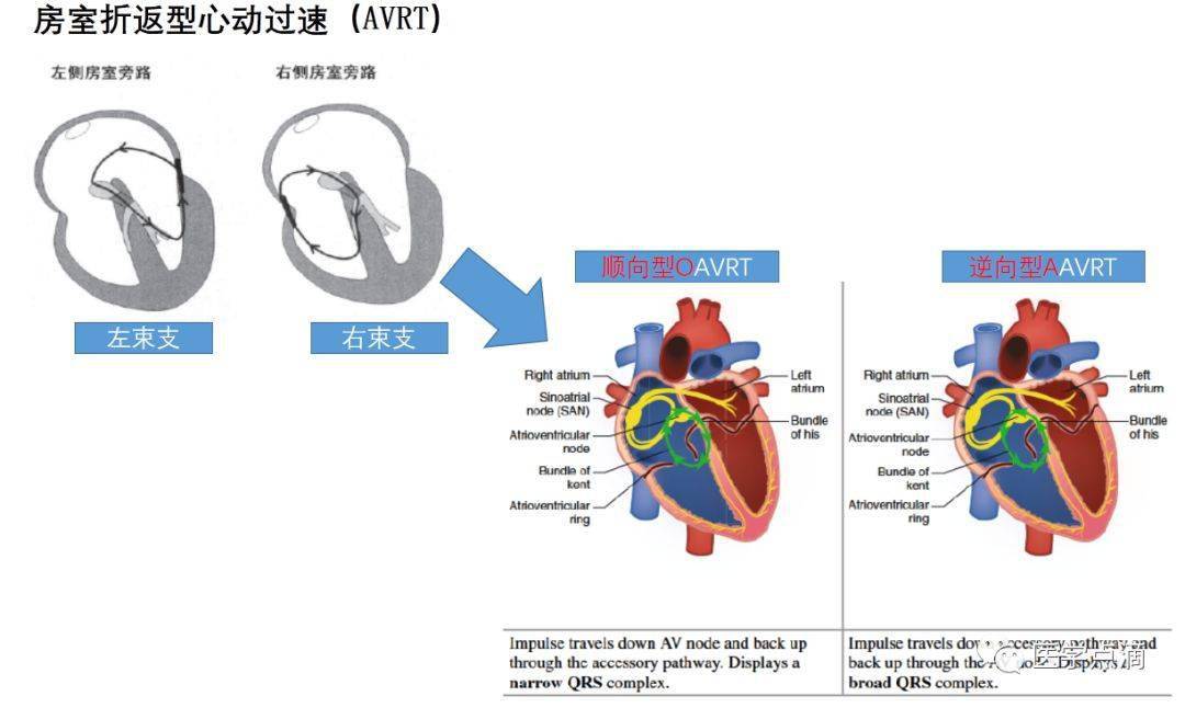 传入侧支性抑制示意图图片