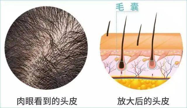 【微医生】宝宝的头发,能越剃越多?_孩子_毛囊_婴儿