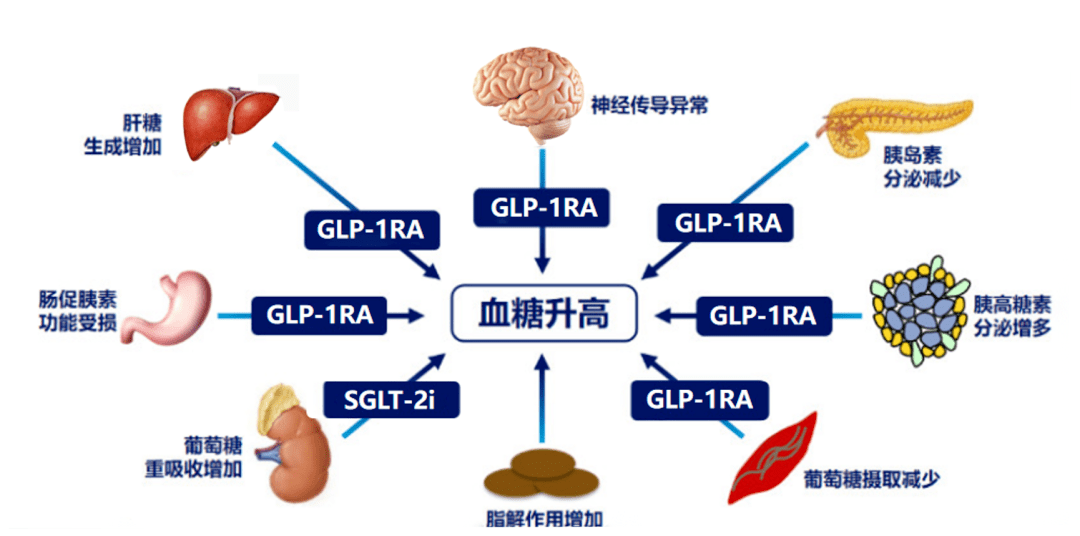 改善神經遞質功能紊亂,作用涵蓋糖尿病發病機制