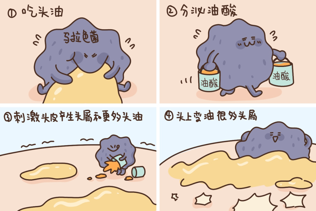 洗头忽略这 3 点,你的头屑永远洗不干净_马拉_头皮屑_受试者