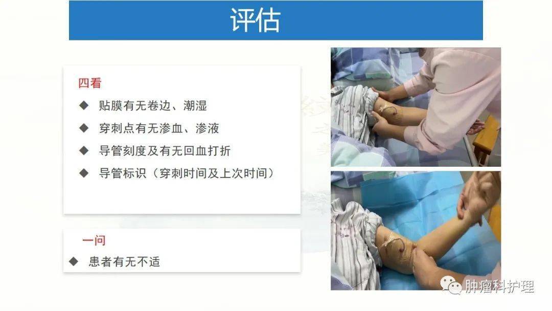 【ppt】經外周靜脈置入中心靜脈導管(picc)的規範化維護_護理_臨床