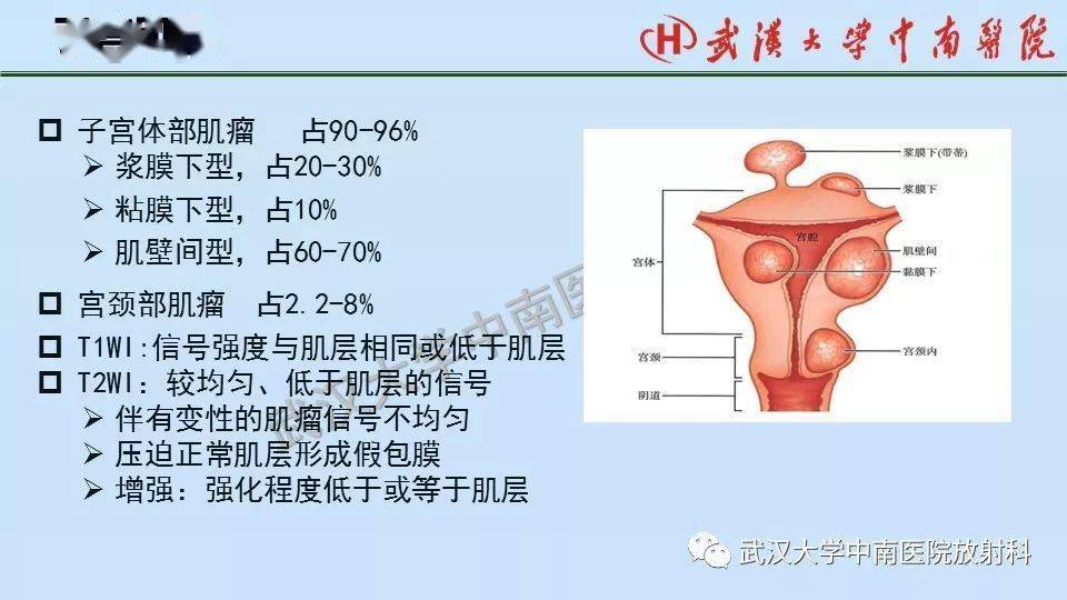 女性生殖系统影像解剖及子宫常见疾病