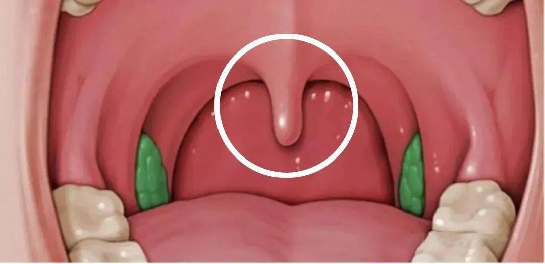 喉咙里的小舌头图片