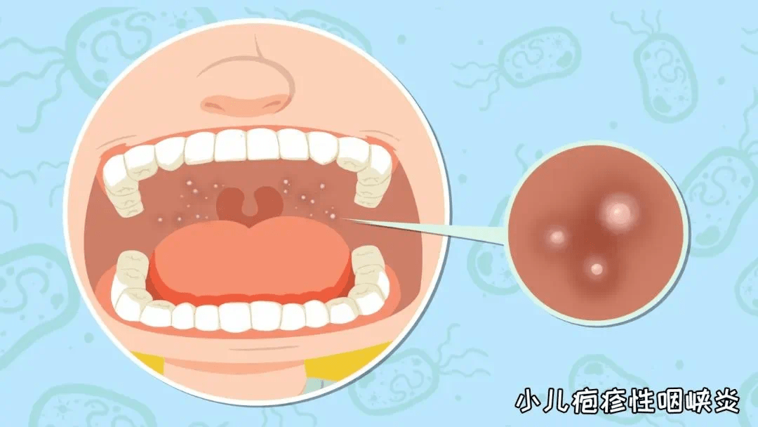 【衛生保健】科學預防 守護健康——磁灶陽光豪庭小金