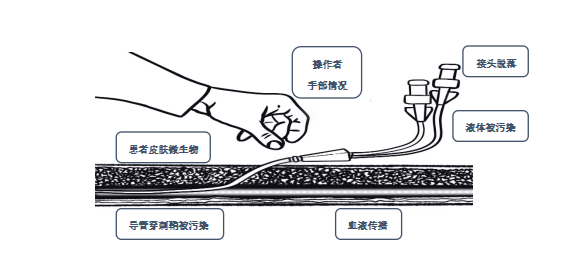 肝素帽怎么封管图片