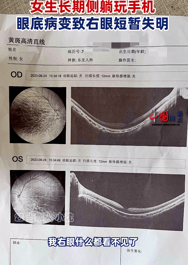 長期近距離看手機,會導致睫狀肌功能下降,出現眼疲勞,且容易誘發視物