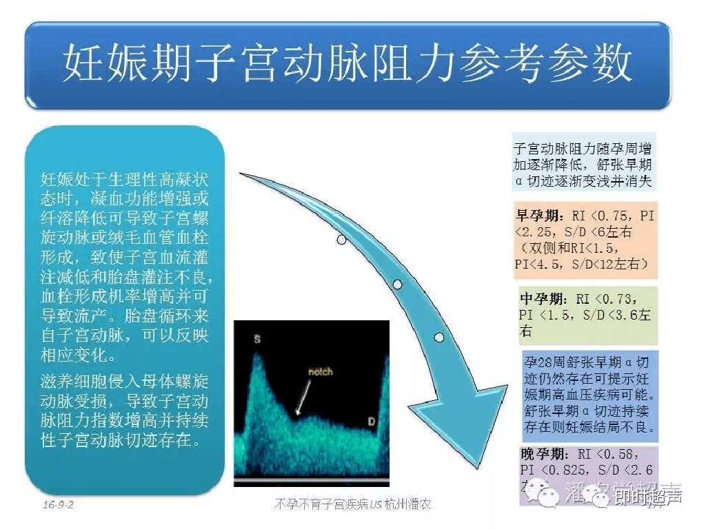 胎兒血流多普勒超聲檢查_動脈_靜脈_大腦